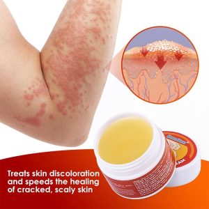 Krema za Psorijazu 50 ml